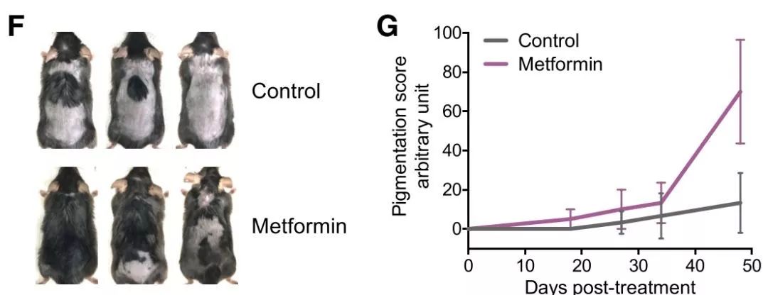 《细胞》子刊：抹二甲双胍能治脱发？华人科学家发现，二甲双胍等诱导自噬的药物，能使休止期毛囊进入生长期，促进毛发再生丨科学大发现