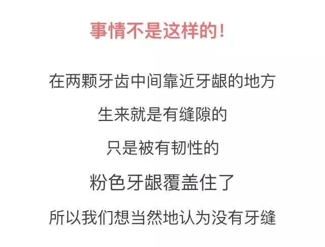 洗牙的真相,洗牙的全过程究竟是怎样的呢