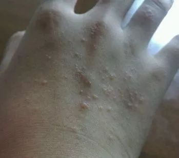 孩子得了治不好的病该如何面对,孩子病了该不该吃药