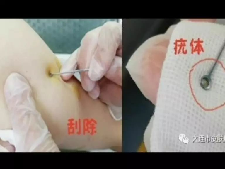 孩子得了治不好的病该如何面对,孩子病了该不该吃药