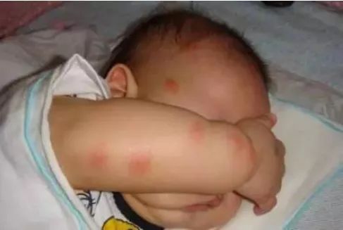 晚上睡觉蚊子太吵怎么办,晚上睡觉蚊子多怎么有效的驱蚊