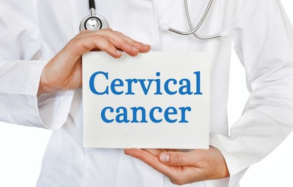 月经异常一年后检查宫颈癌晚期,55岁来月经是宫颈癌的前兆吗