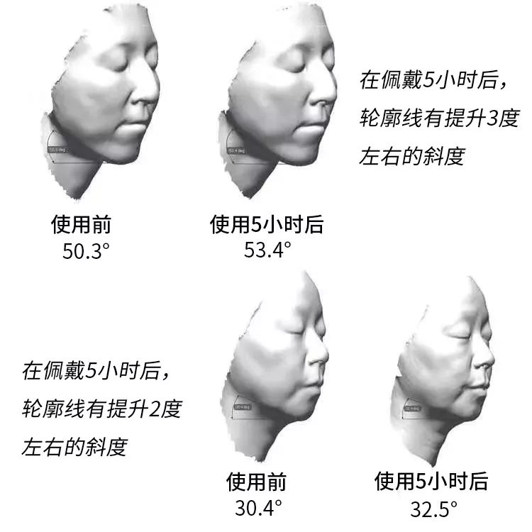 日本黑科技磁石瘦脸耳环,日本磁吸瘦脸耳环