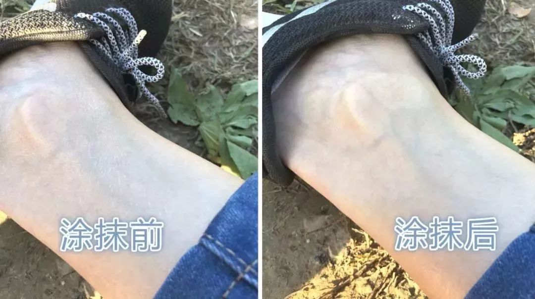 保湿、消炎、止痒、晒后修复，一管芦荟胶全搞定，宝宝也能用