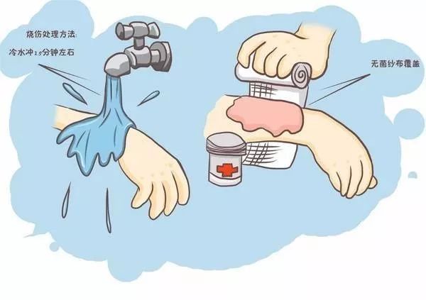 临床烫伤急救处理,医师怎么处理烫伤