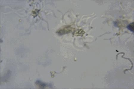 2000亿的细菌,哪种菜板不容易滋生细菌