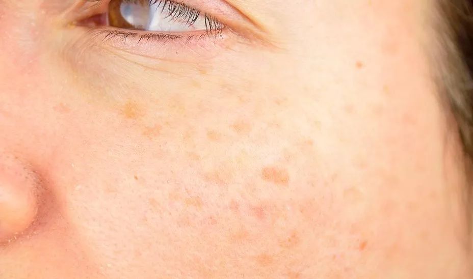 连脖子防晒口罩夏天透气,连着护耳朵的口罩