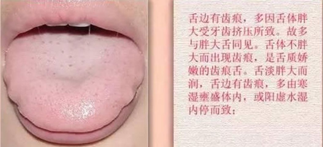 气喘咳嗽嗓子有痰是什么病,长期咳嗽要警惕哮喘