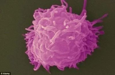 戴隐形眼镜感染的寄生虫,戴隐形眼镜眼睛里长虫子