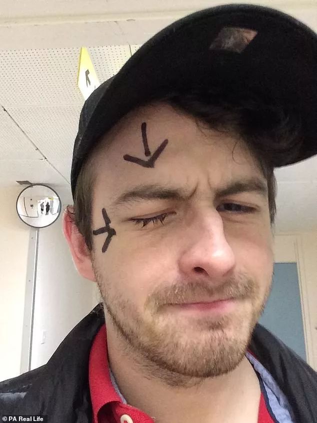 戴隐形眼镜感染的寄生虫,戴隐形眼镜眼睛里长虫子