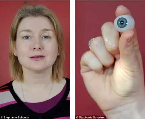 戴隐形眼镜感染的寄生虫,戴隐形眼镜眼睛里长虫子