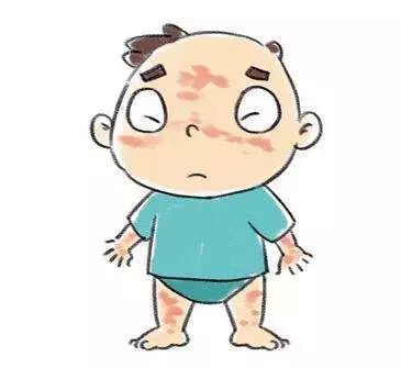 湿疹反复不好知道这3点早预防,湿疹反反复复是什么类型的湿疹