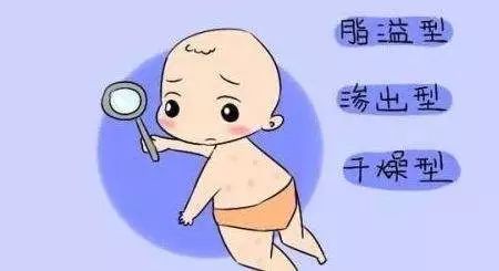 湿疹反复不好知道这3点早预防,湿疹反反复复是什么类型的湿疹