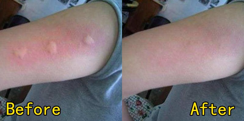 植物萃取喷雾防蚊驱蚊,驱蚊喷雾植物萃取温和不刺激