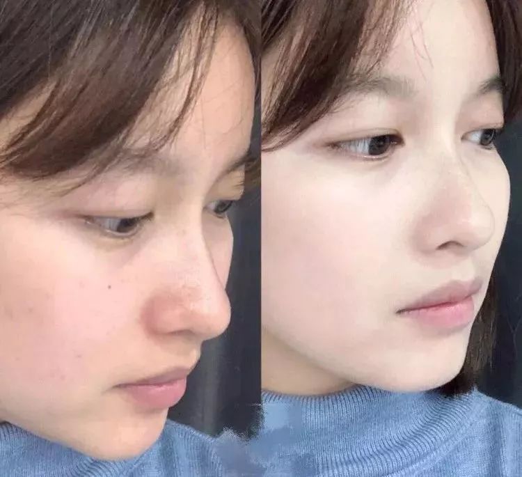 懒人美白黑科技,黑科技一秒变白的神器