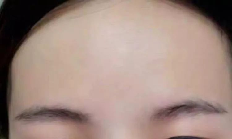 纹眉一周后眉毛还没完全掉痂,纹眉之后我的眉毛不长了