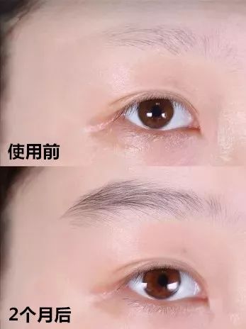 纹眉一周后眉毛还没完全掉痂,纹眉之后我的眉毛不长了