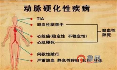 糖尿病医疗突破,糖尿病微创介入