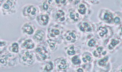 2000亿的细菌,哪种菜板不容易滋生细菌