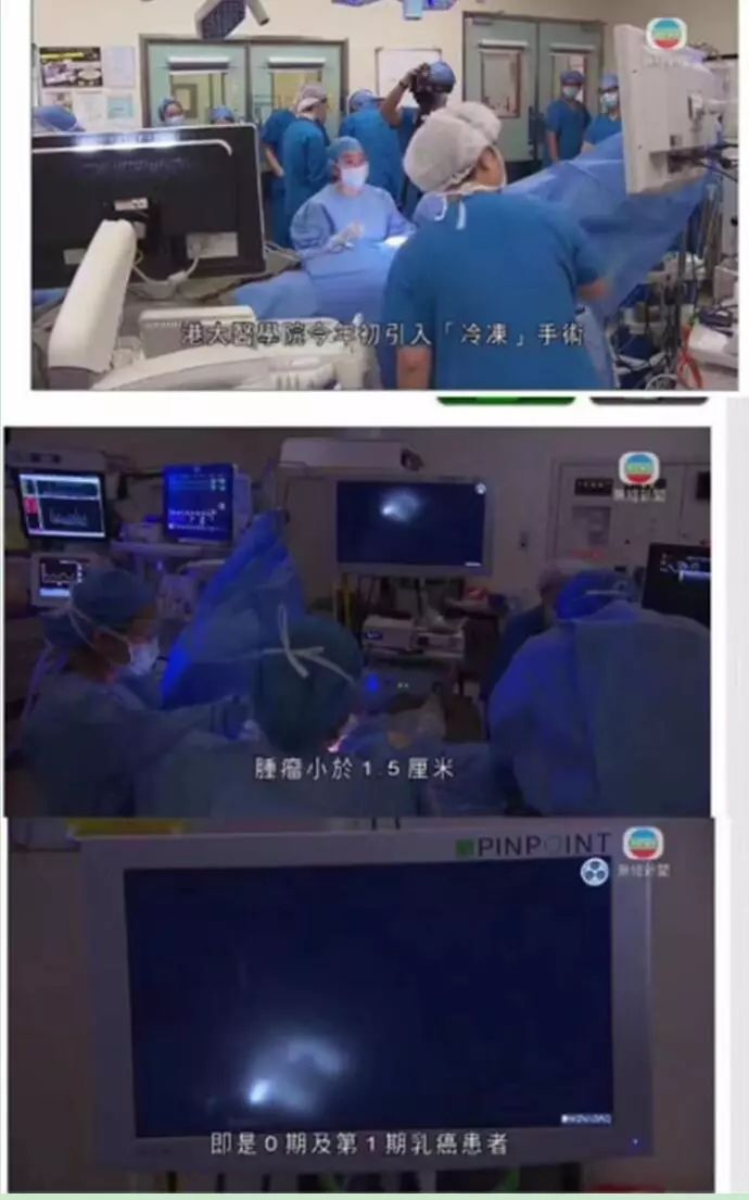 冷冻治疗的恢复需要多久,冷冻治疗恢复过程图片