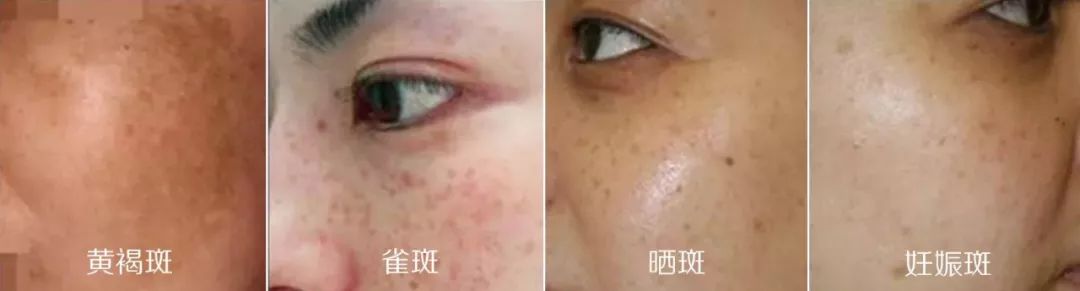 刚秀完恩爱,刚秀恩爱就被分手
