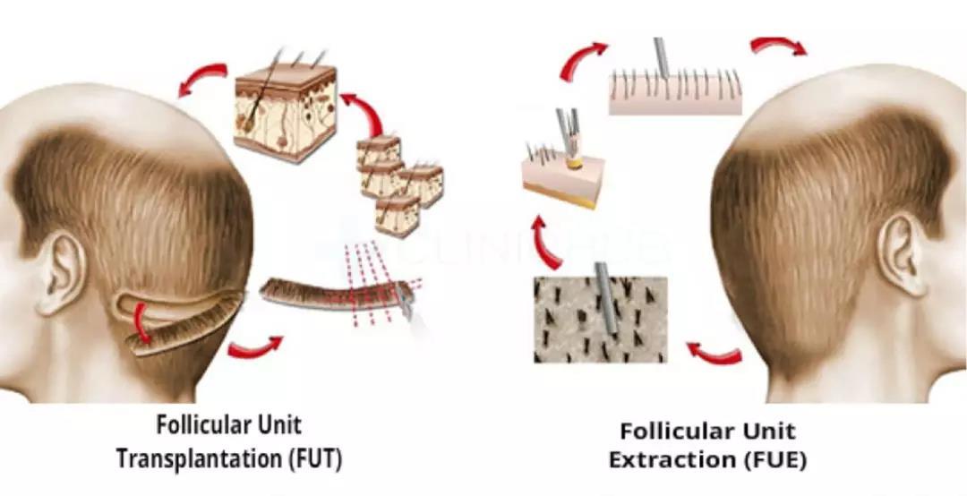 4岁孩子长小胡须,4岁小男孩长小胡须