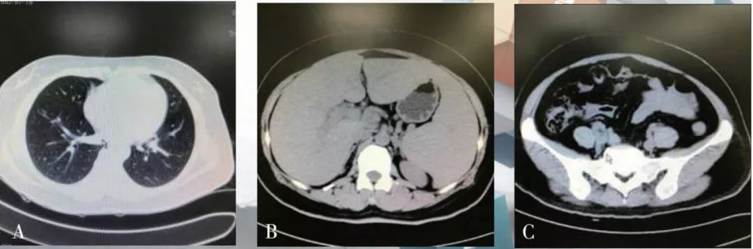 肝病核心力量锻炼,肝病引起脾肿大怎么治