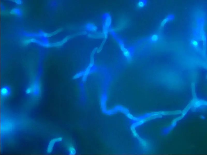 鍏釜鏈堢殑瀹濆疂鑴氫細鎬庢牱,8涓湀瀹濆疂鑴氶兘鏄箍鐤瑰悧