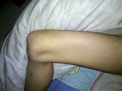 引起肌肉萎缩的原因,如何正确快速的诊断肌肉萎缩疾病