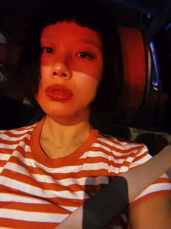 大龄整牙,错过生长发育期怎么办