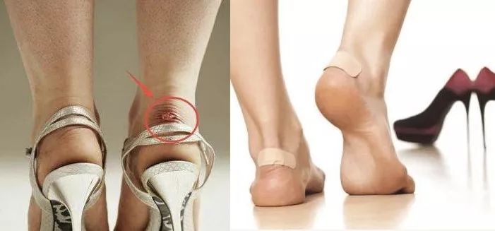 比创可贴好用,最好用的液体创可贴