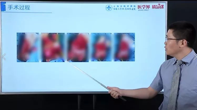 泌尿外科医生的「尿道修复重建」超实用锦囊