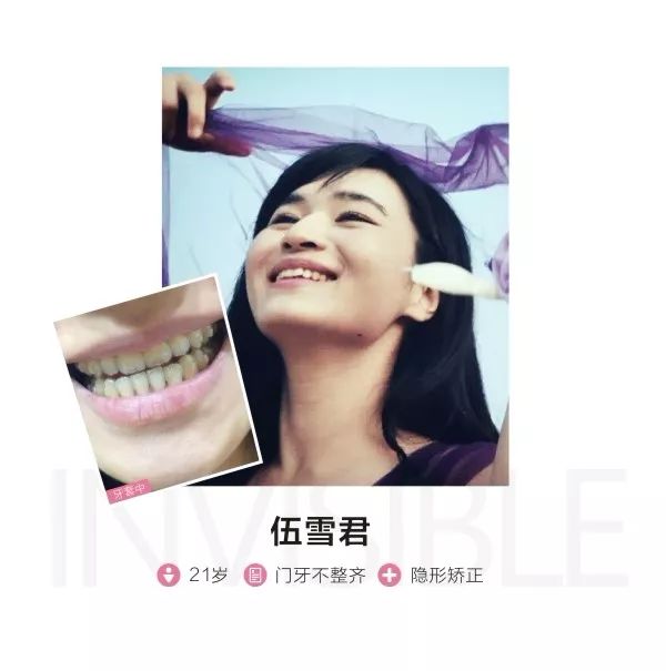 别人矫牙1万起，广州只要3960元！仅限2天