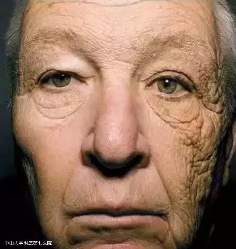 越晒越白越好的防晒方法,一白遮百丑夏日防晒大科普