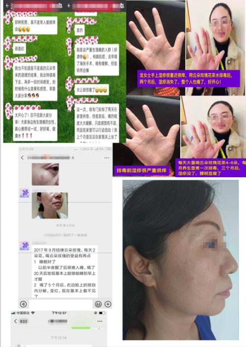 云朵玫瑰值得投资吗,云朵玫瑰代理