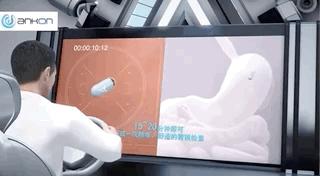 中国磁控胶囊胃镜临床应用指南书,磁控胶囊胃镜临床意义