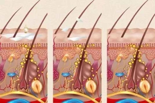 脱发自救指南,你的脱发自救指南建议耐心看完