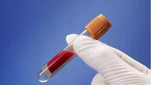 慢性乙肝防治指南的解读,慢性乙肝病人寿命