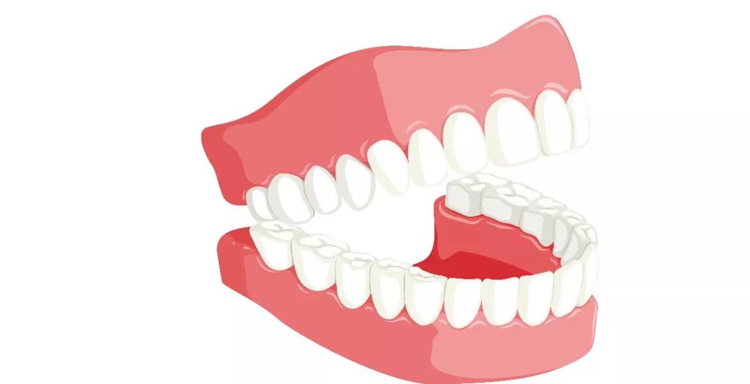 牙缝太大会有影响吗,牙缝大会影响颜值么