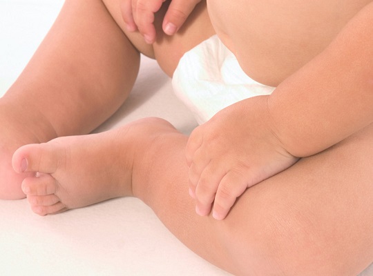 宝宝肚脐出了鼓包，大多不用治