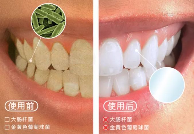 小编推荐丨缓解咳嗽、口臭，试试这个“千金方”！澳洲纯植物提取