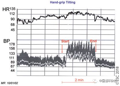 2022晕厥诊断与治疗指南,esc最新临床指南
