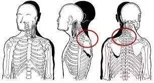 腿越来越粗越来越沉,肌肉腿怎么变细变直拉伸
