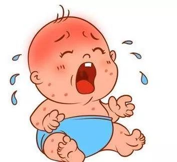 疫苗接种导致的不良反应,打甲肝疫苗和麻腮风疫苗不良反应