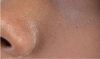 脸上搓下来很多泥,脸上搓出黑头