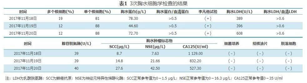 胸腺鳞癌一例并文献复习