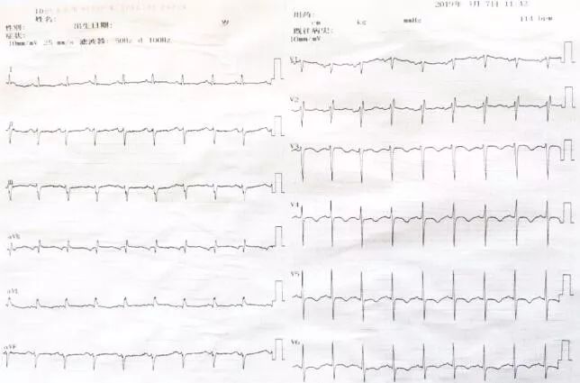 在线心内会诊室丨新妈妈呼吸困难、下肢水肿，她怎么啦？