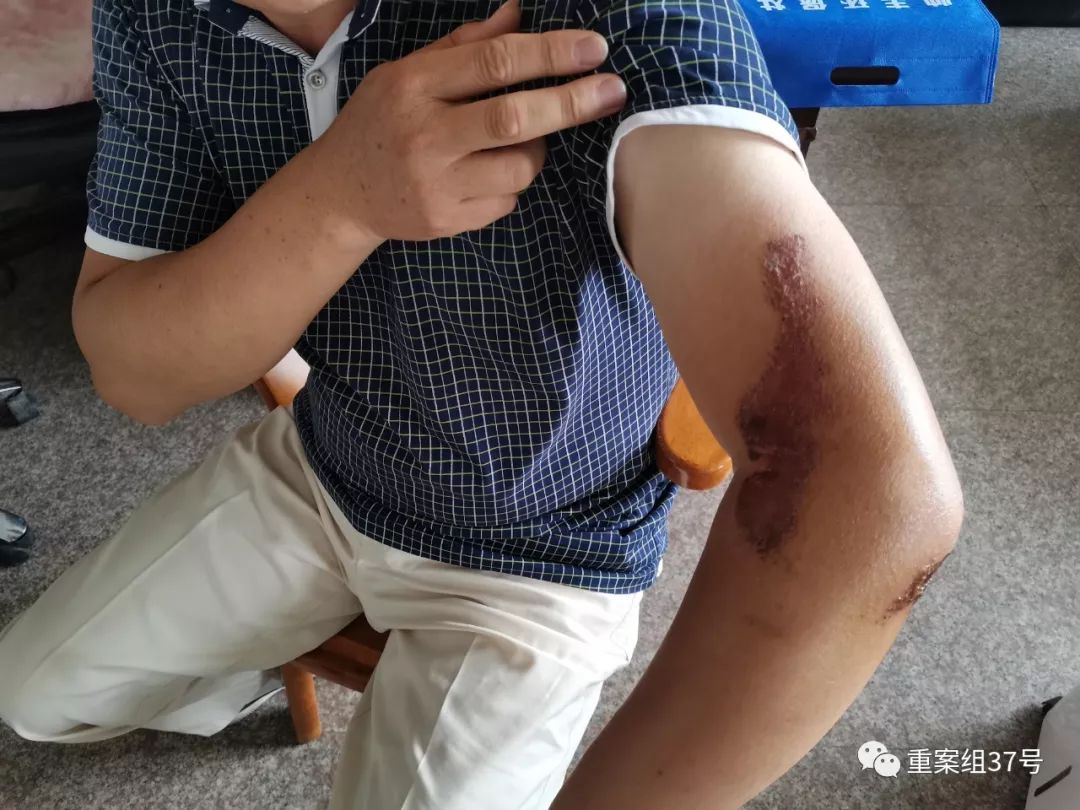 浙江龙泉企业家举报路上被撞背后，多家民企身陷借贷联保漩涡