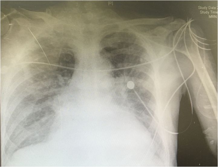 心内科张海涛,阜外医院张海涛讲心衰