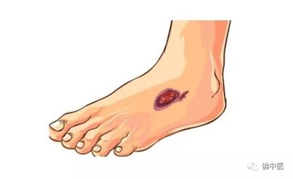 泌尿系结石科普十问,泌尿系结石患者饮食指导原则